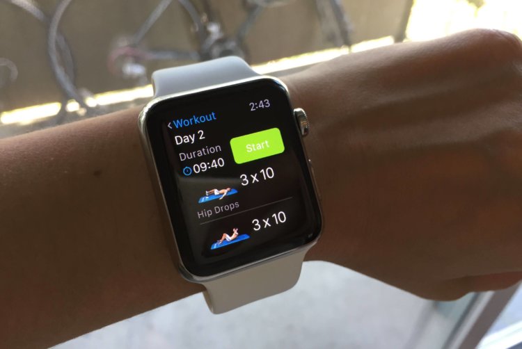 Реально ли получить ожог от Apple Watch? Фото.