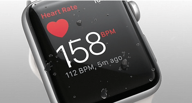 Apple Watch назвали самым точным фитнес-устройством. Фото.
