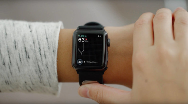 Следующее поколение Apple Watch могут оснастить датчиком ЭКГ. Фото.