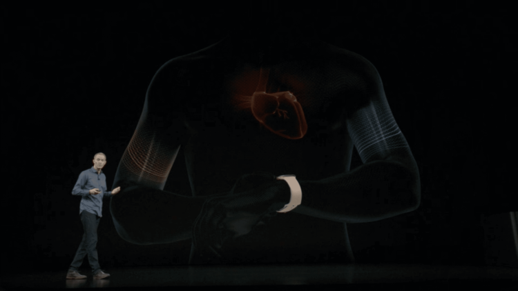 ЭКГ в Apple Watch — только начало. Что будет дальше? ЭКГ в Apple Watch — только начало. Что будет дальше? Фото.