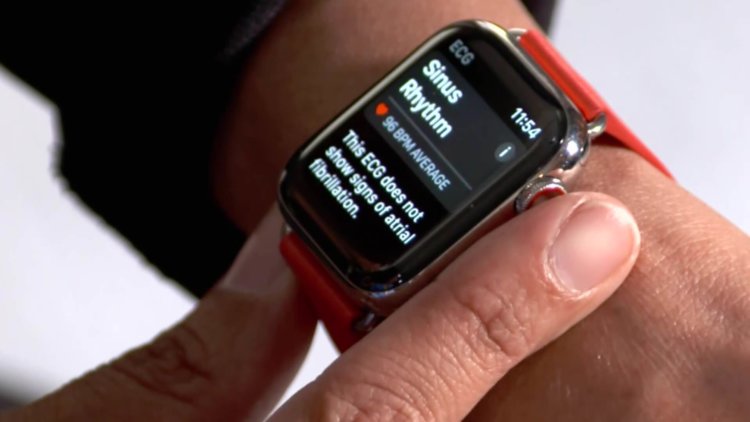 Как активировать приложение ЭКГ на Apple Watch Series 4 в России. Как активировать приложение ЭКГ на Apple Watch Series 4 в России. Фото.