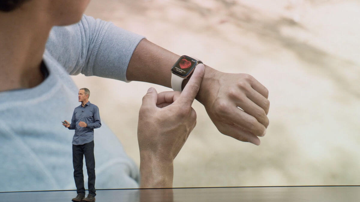 Диагностика аритмии с помощью Apple Watch. Если вы хотите купить Apple Watch только ради функции ЭКГ, лучше этого не делать. Диагностика аритмии с помощью Apple Watch. Если вы хотите купить Apple Watch только ради функции ЭКГ, лучше этого не делать. Фото.