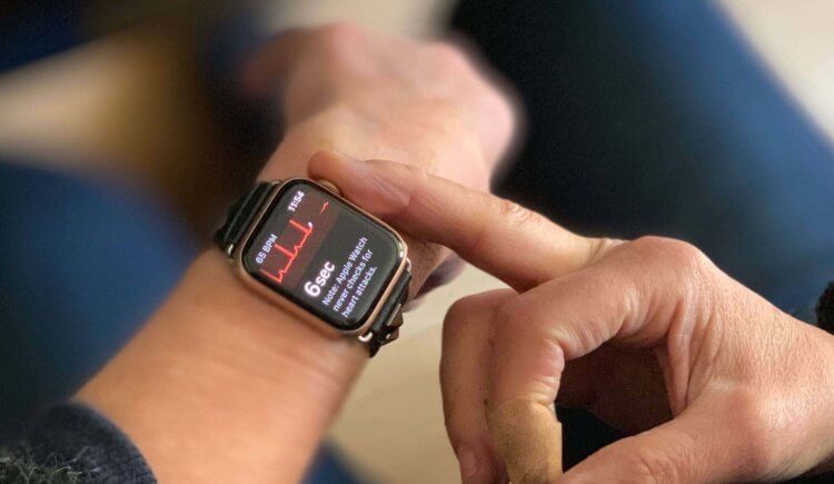Что не так с Apple Watch. Фото.