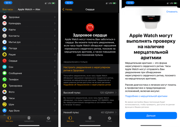 Как включить ЭКГ на Apple Watch в России. ЭКГ теперь работает и в России. Как включить ЭКГ на Apple Watch в России. ЭКГ теперь работает и в России. Фото.