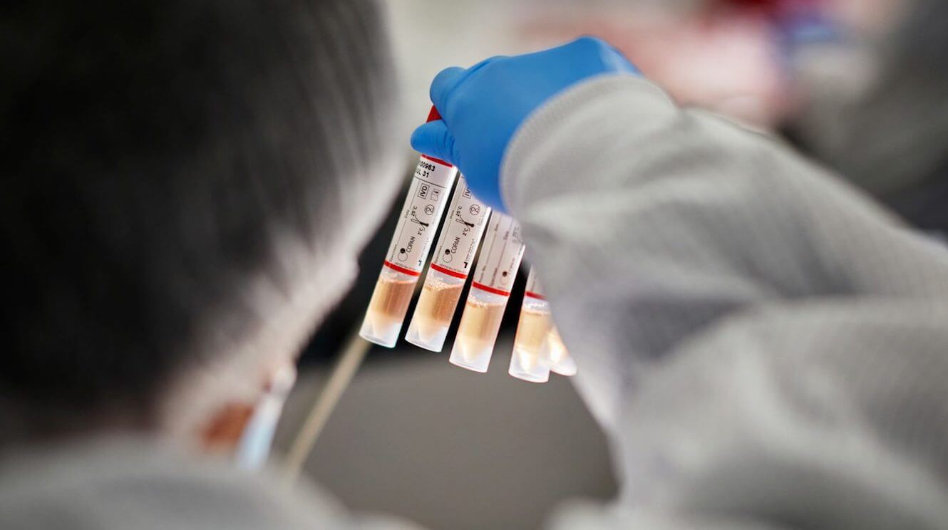 Apple рассказала, как помогает делать тесты на COVID-19. Фото.