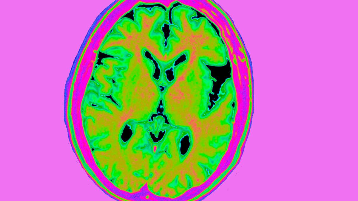 Apple уже давно изучает ментальные расстройства и учит Apple Watch их диагностировать. Фото.