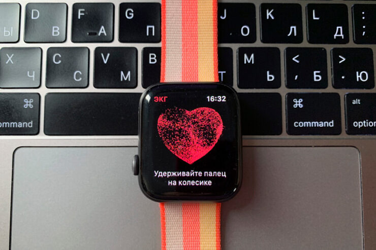 ЭКГ все умеют снимать. Вы давление измерить попробуйте. Фото.