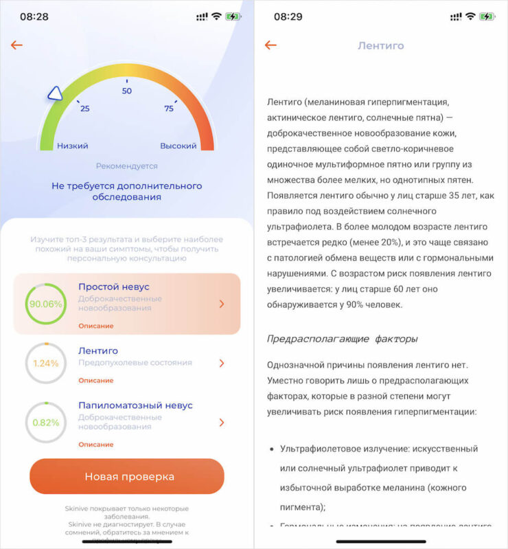 Опасна родинка или нет — как узнать. А, чтобы вам всё было понятно, Skinive предлагает ещё и подробное описание предполагаемого расстройства. Опасна родинка или нет — как узнать. А, чтобы вам всё было понятно, Skinive предлагает ещё и подробное описание предполагаемого расстройства. Фото.