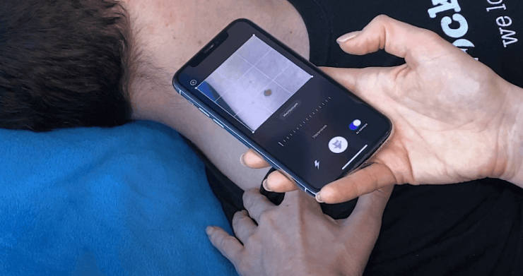 На iPhone вышло приложение Skinive, которое определяет болезни кожи по фото. Как оно работает. Skinive — это приложение для распознавания болезней кожи. На iPhone вышло приложение Skinive, которое определяет болезни кожи по фото. Как оно работает. Skinive — это приложение для распознавания болезней кожи. Фото.