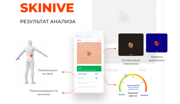 Болезни кожи — как выявлять. Оказывается, теперь и телефон может определить признаки кожных заболеваний. Болезни кожи — как выявлять. Оказывается, теперь и телефон может определить признаки кожных заболеваний. Фото.