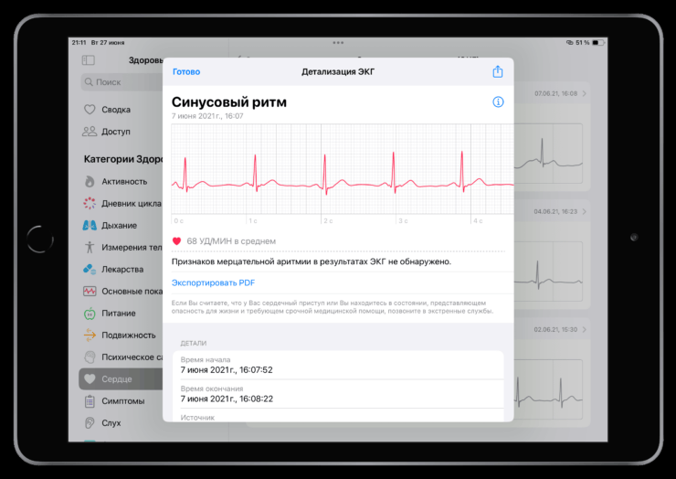 Что есть в Здоровье на Айпаде. ЭКГ значительно удобнее просматривать на большом экране планшета. Фото.