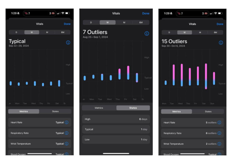 Отслеживание сна на Apple Watch. В течение всего периода болезни Apple Watch тоже фиксируют отклонения. Изображение: reddit.com. Фото.