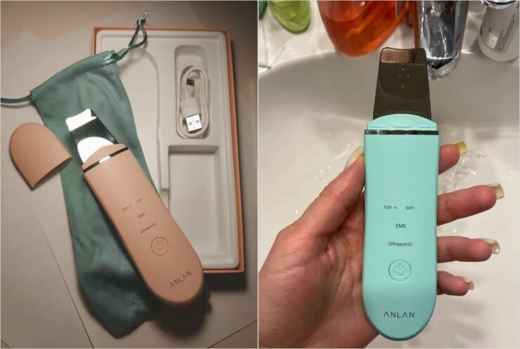 Как избавиться от черных точек на лице. В отзывах очень много довольных мужчин, так что берите на заметку. Фото.