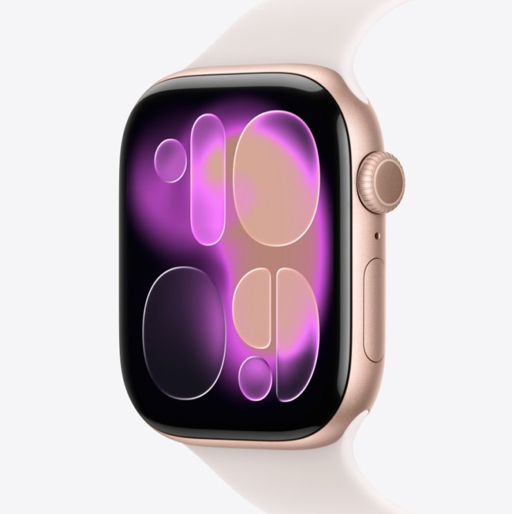 Apple Watch Series 11 - фото