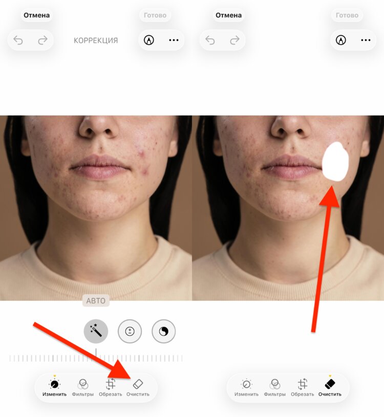 Как удалить прыщи встроенными средствами iPhone. Ничего сложного, просто нужно внимательно обработать все проблемные участки. Как удалить прыщи встроенными средствами iPhone. Ничего сложного, просто нужно внимательно обработать все проблемные участки. Фото.
