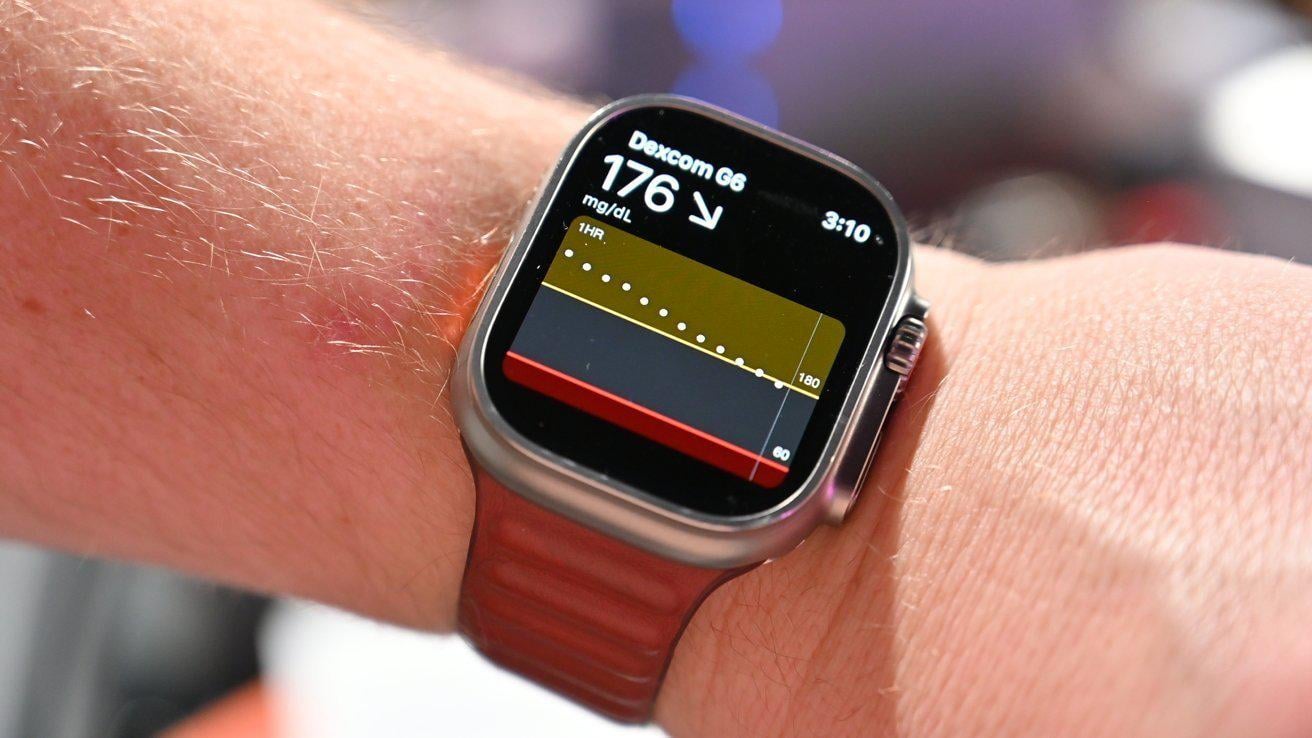 Будет ли в Apple Watch измерение сахара без прокола. А вот неинвазивный глюкометр ждать точно не стоит. Фото.