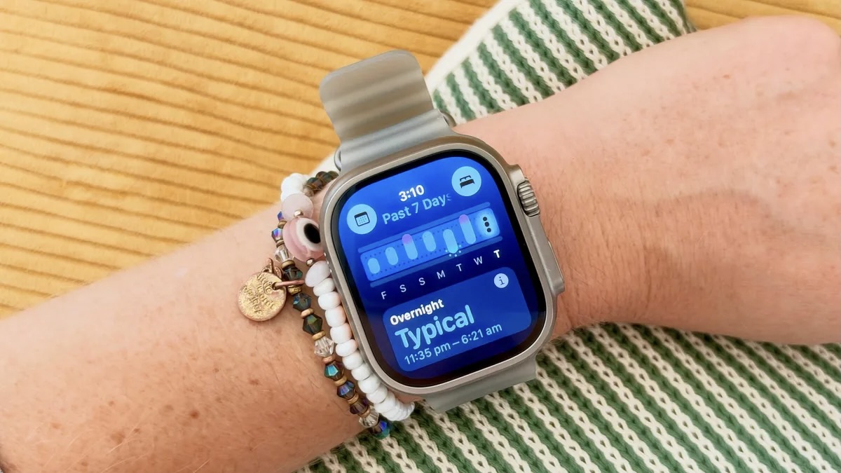 Правильное расположение Apple Watch на руке